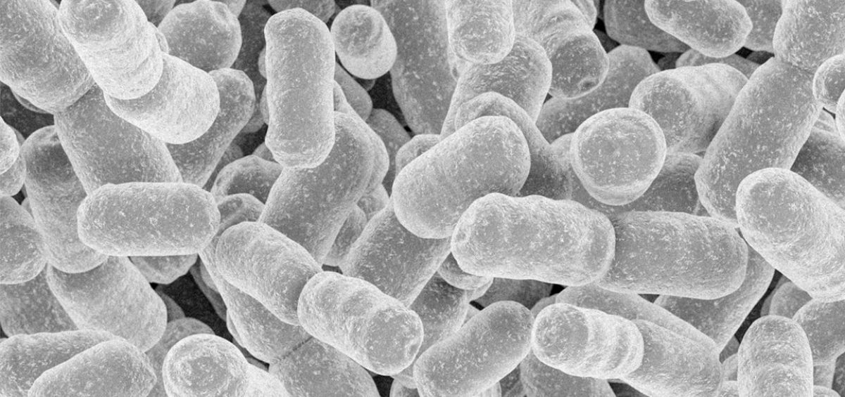 生きた乳酸菌と死んだ乳酸菌で効果に違いはあるの？