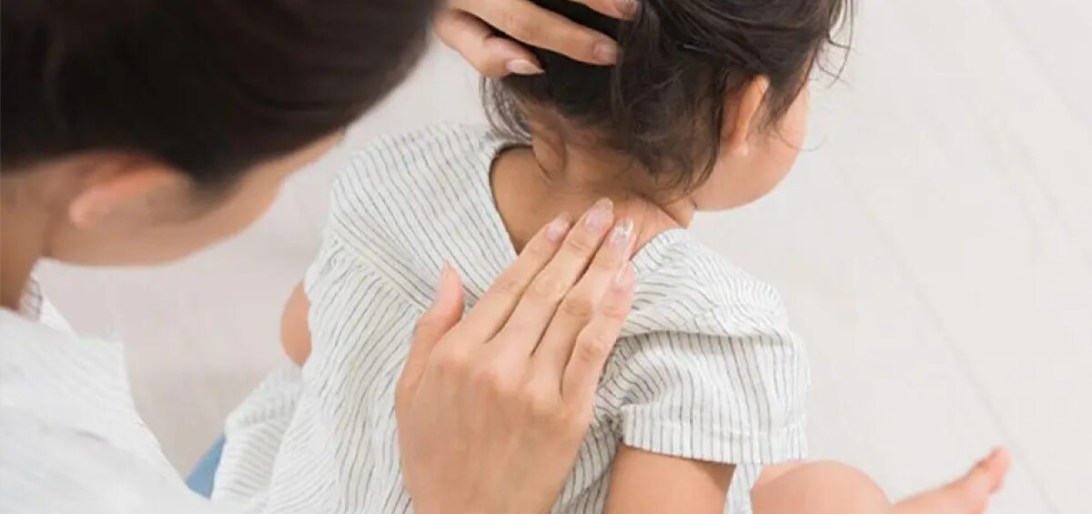 【小児皮膚科医の視点】子どもの頭の痒みなぜ起こる？免疫常識